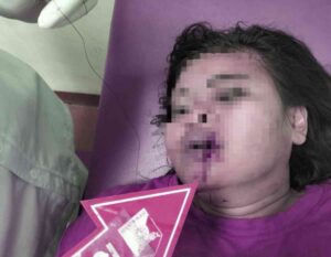 Bacok Teman Kerja, Wanita Pekerja Kafe di Labuhanbatu Ditangkap Polisi