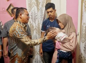 Wakil Walikota Medan Kunjungi Mikhayla, Balita Penderita Kanker Mata