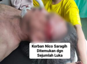 Wartawan Media Online di Medan Nico Saragih Ditemukan Tewas, Ada Luka di Wajah dan Kepala